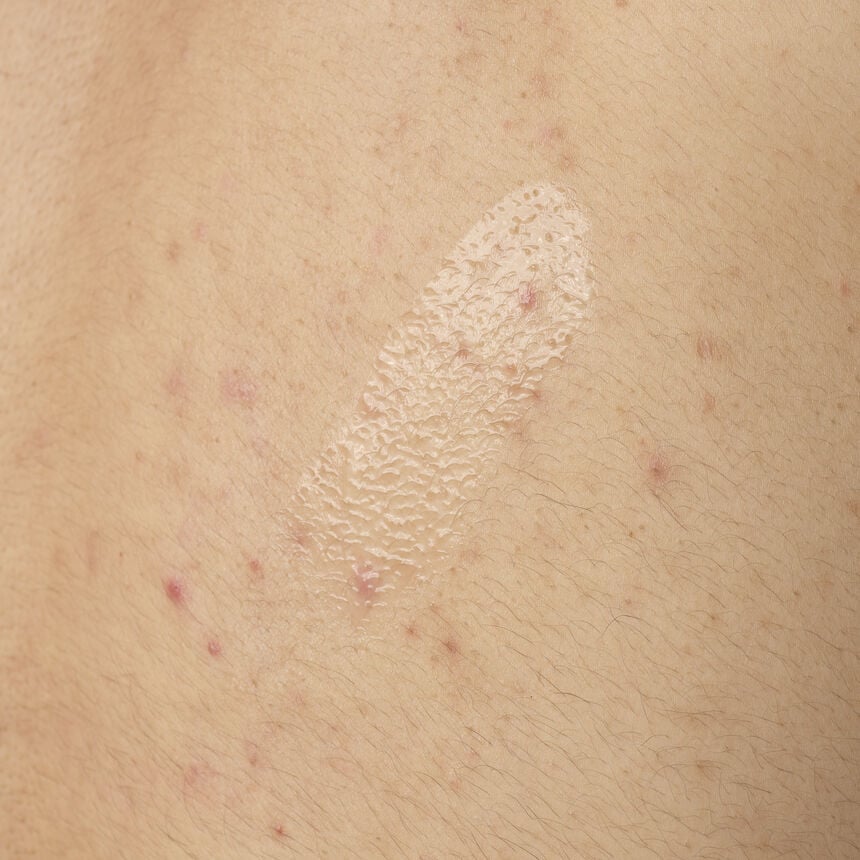 The INKEY Skin Salicylic Acid 0.5% Body Serum - Image 4