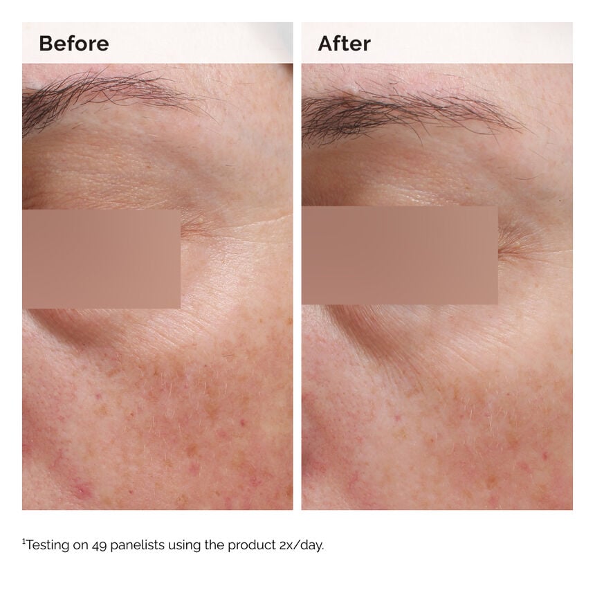 Niacinamide 5% Face and Body Emulsion - Image 2