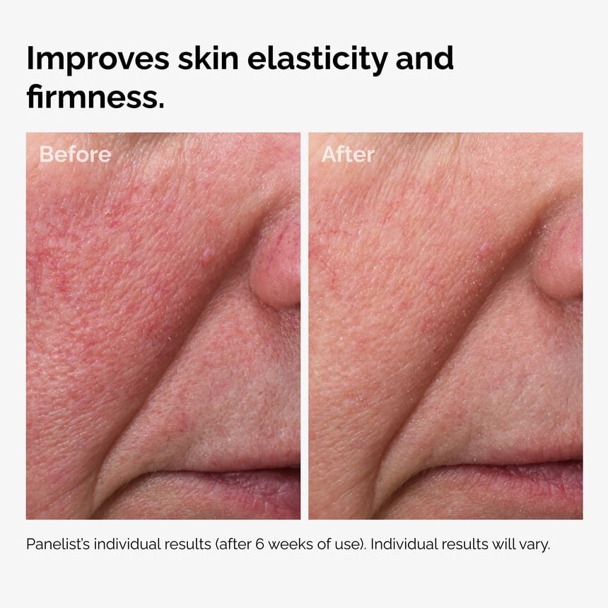 The INKEY Skin Fermented Rose Hip Seed Oil - Image 5