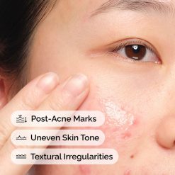 Alternative view of The INKEY Skin Aloe 2% + NAG 2% Face Serum