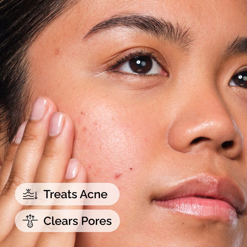 The INKEY Skin Salicylic Acid 2% Face Serum - Image 5