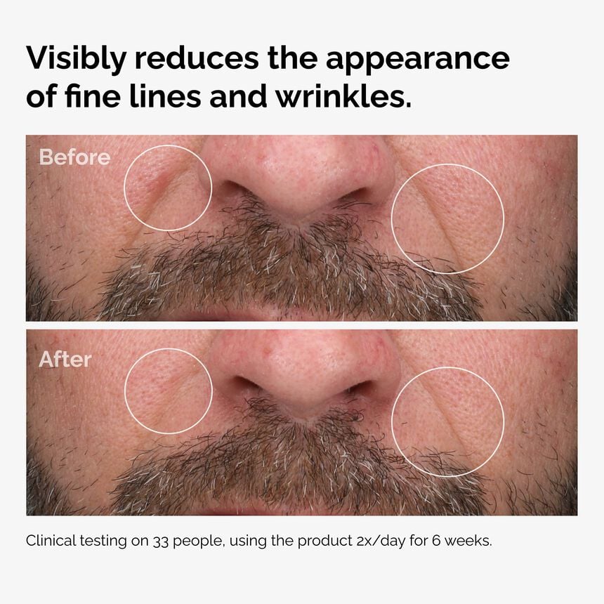 The INKEY Skin Fermented Rose Hip Seed Oil - Image 6