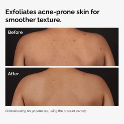 Alternative view of The INKEY Skin Salicylic Acid 0.5% Body Serum